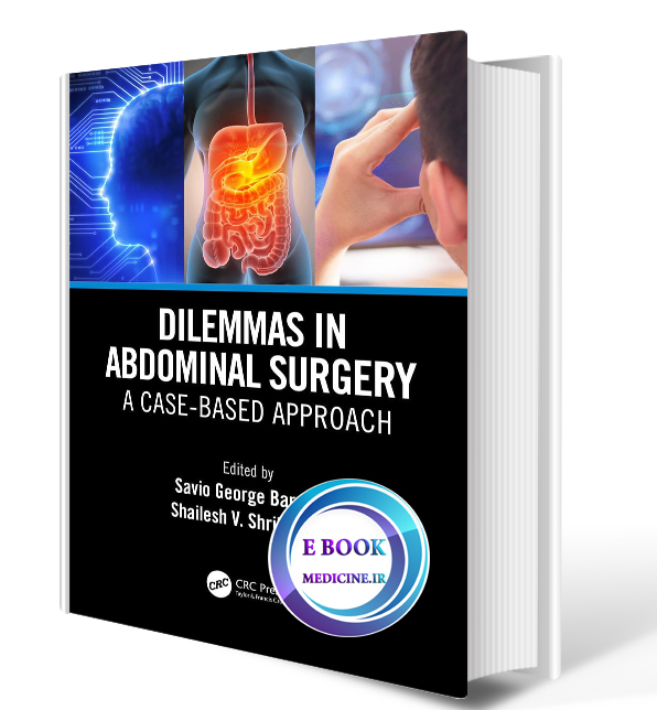 دانلود کتاب Dilemmas in Abdominal Surgery A Case-Based Approach2020 (ORIGINAL PDF) )